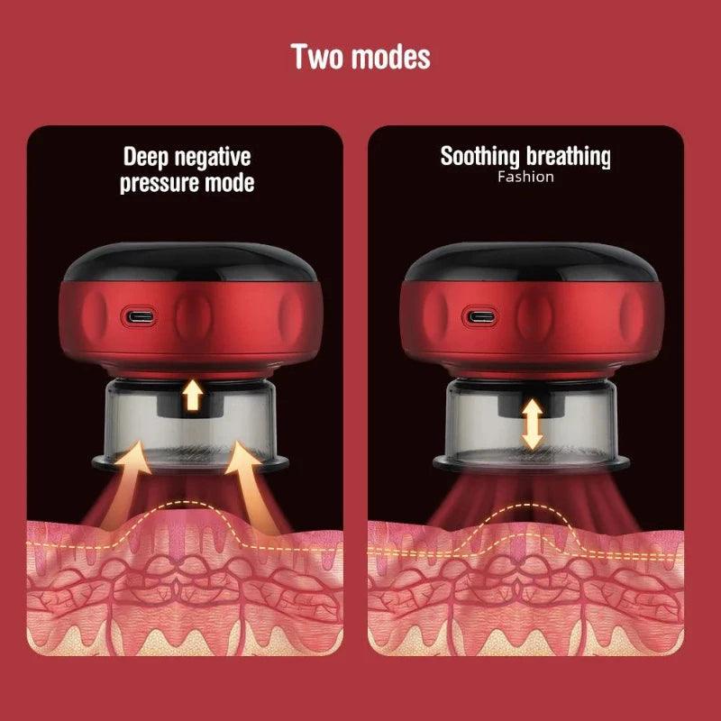 Electric Vacuum Cupping Massage Device - FLUAFF