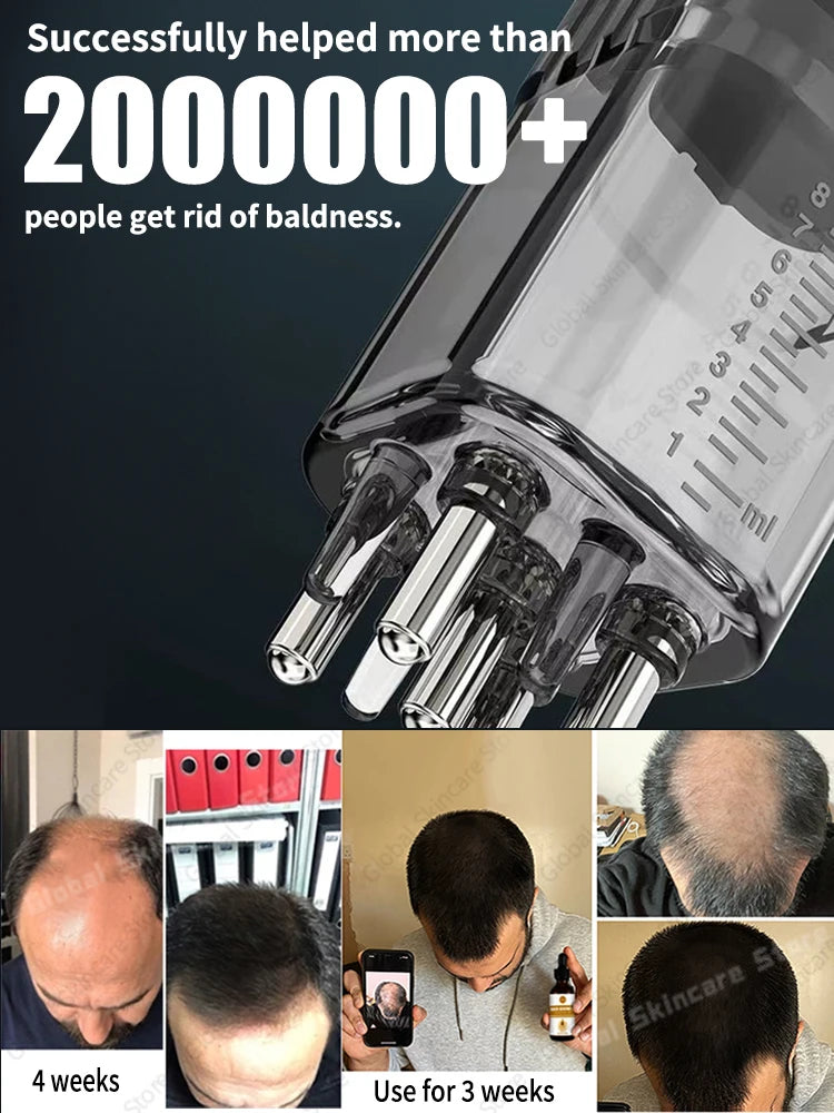 Scalp Applicator Head Oil Roller Ball Massage