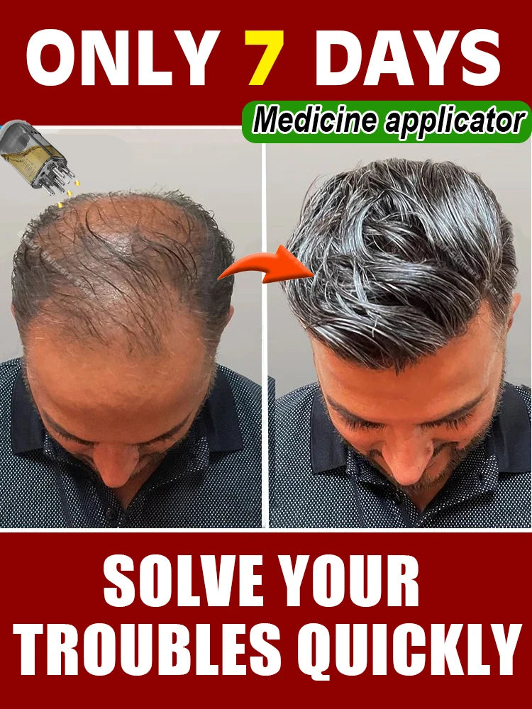 Scalp Applicator Head Oil Roller Ball Massage